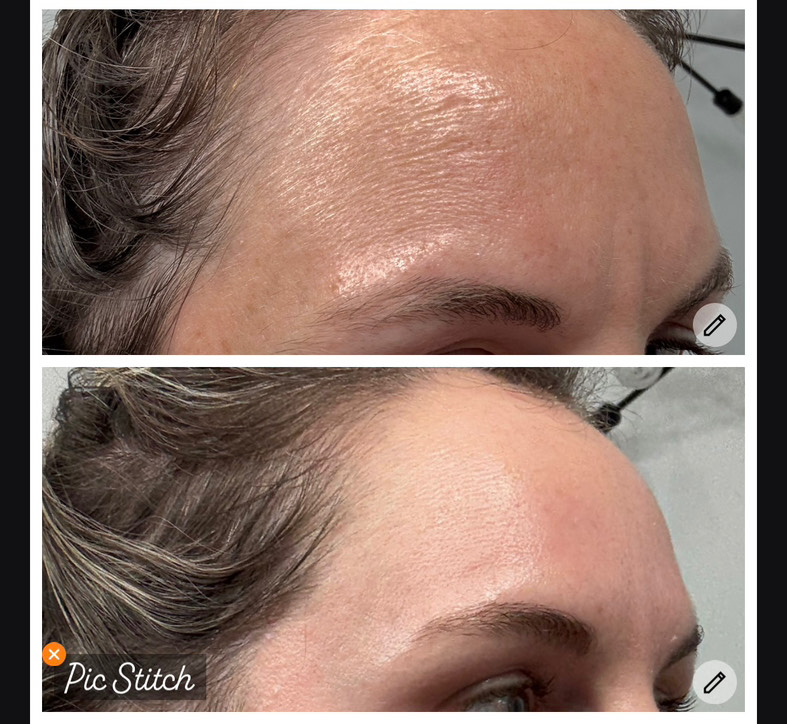 The Spot Peel review photo by Emily B.