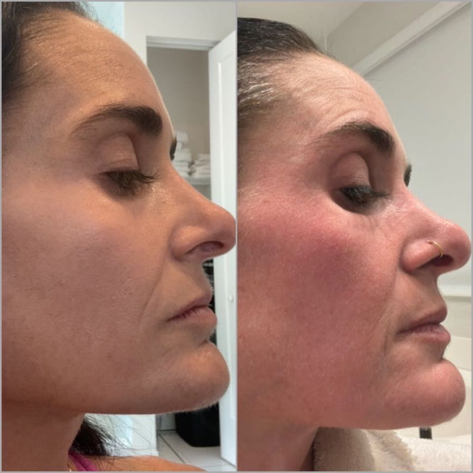 Customer photo