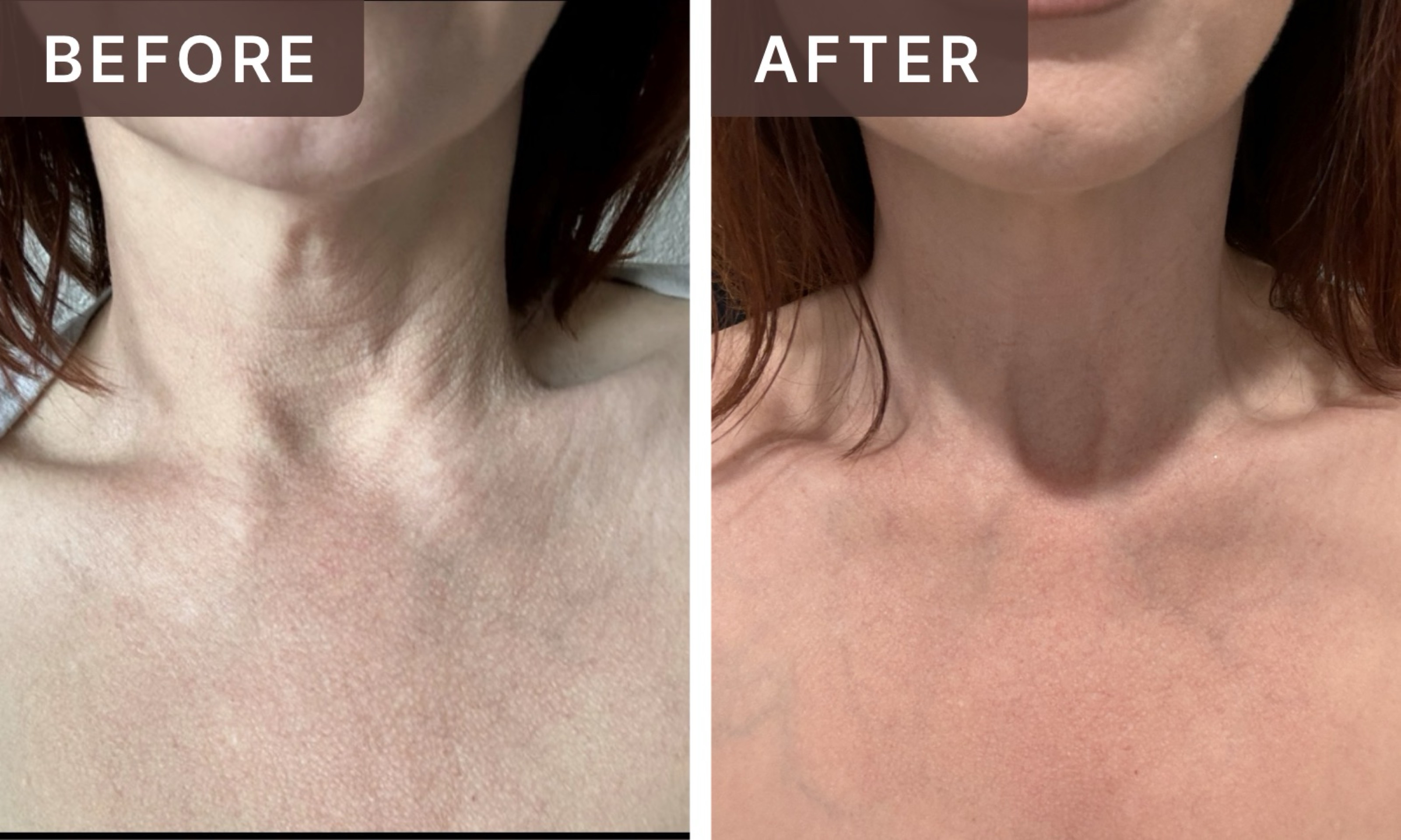 Rachael F. -- before and after, 12 weeks