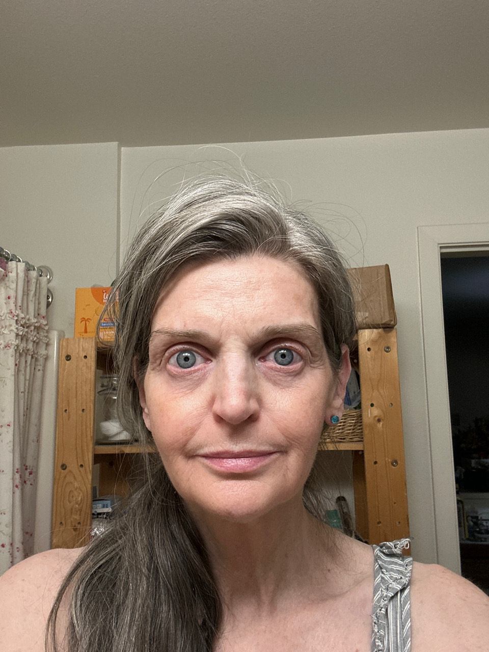 Review photo by Musely Prescription Skincare T.