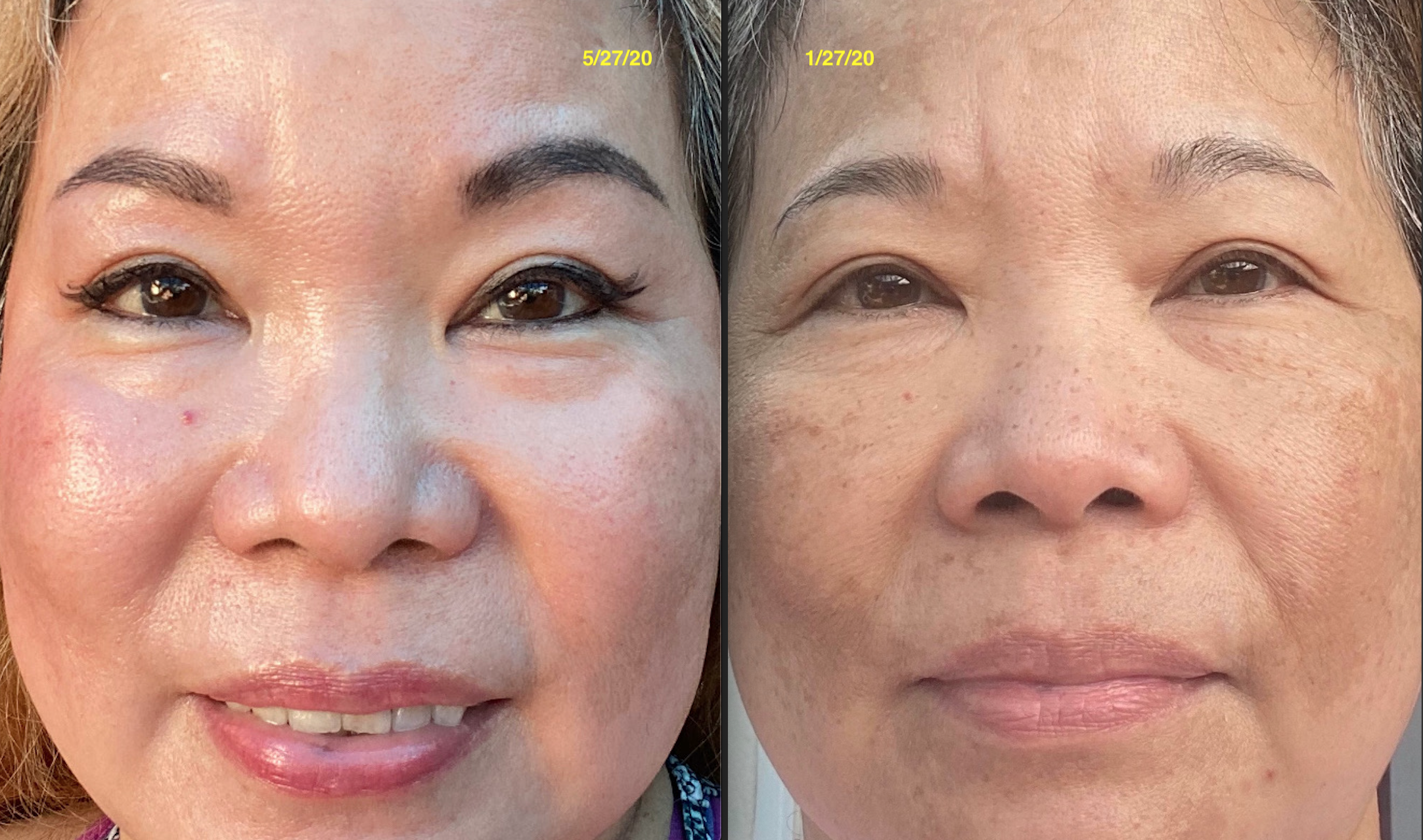 The Spot Cream review photo by Mochi H.