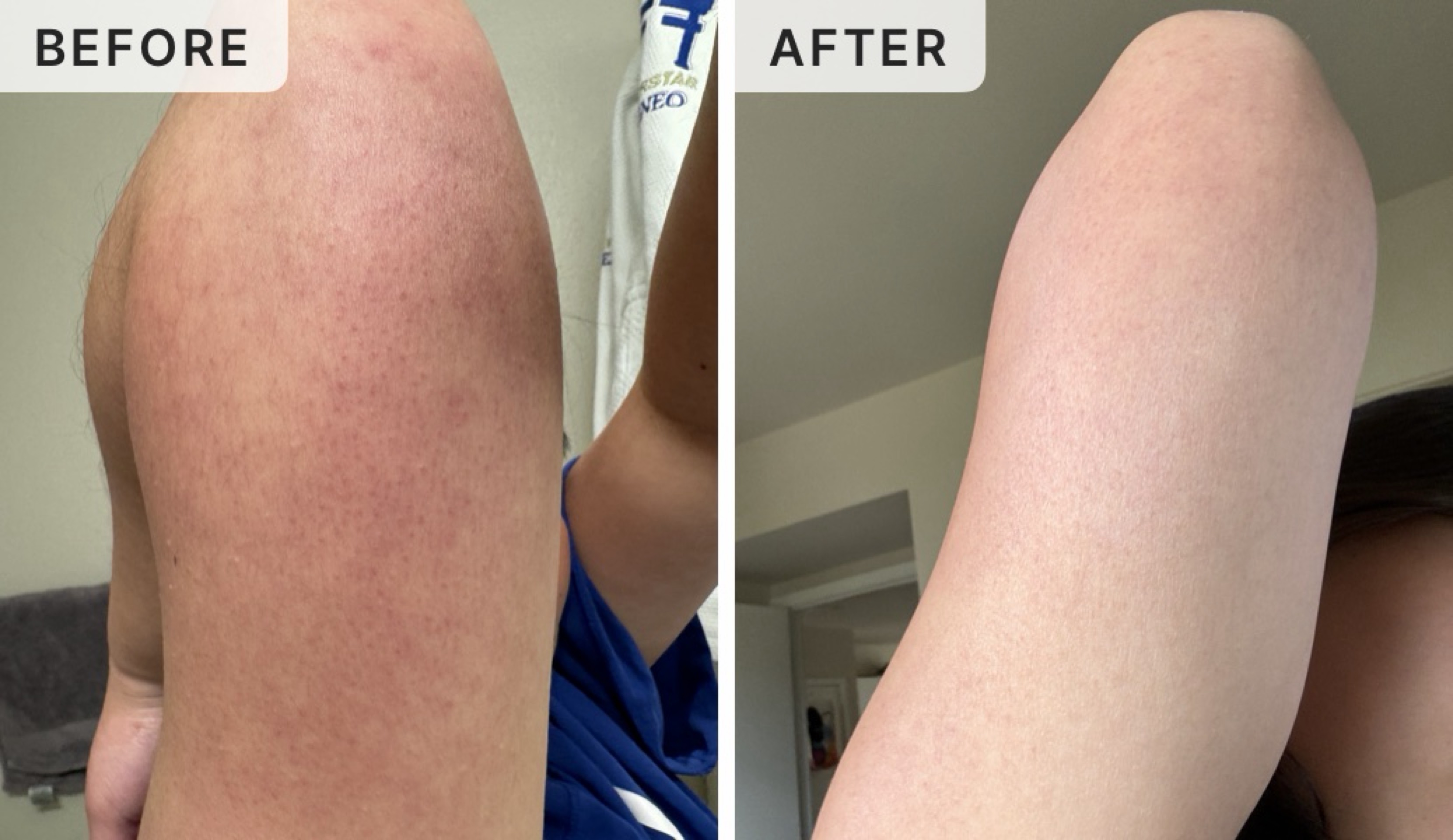 Aly C. -- before and after, 8 weeks