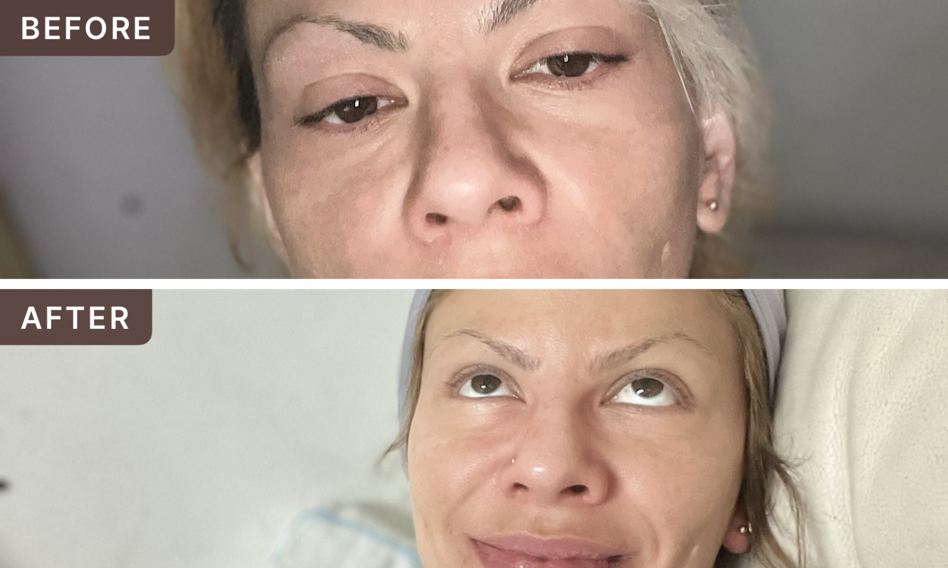 Tania G. -- before and after, 8 weeks