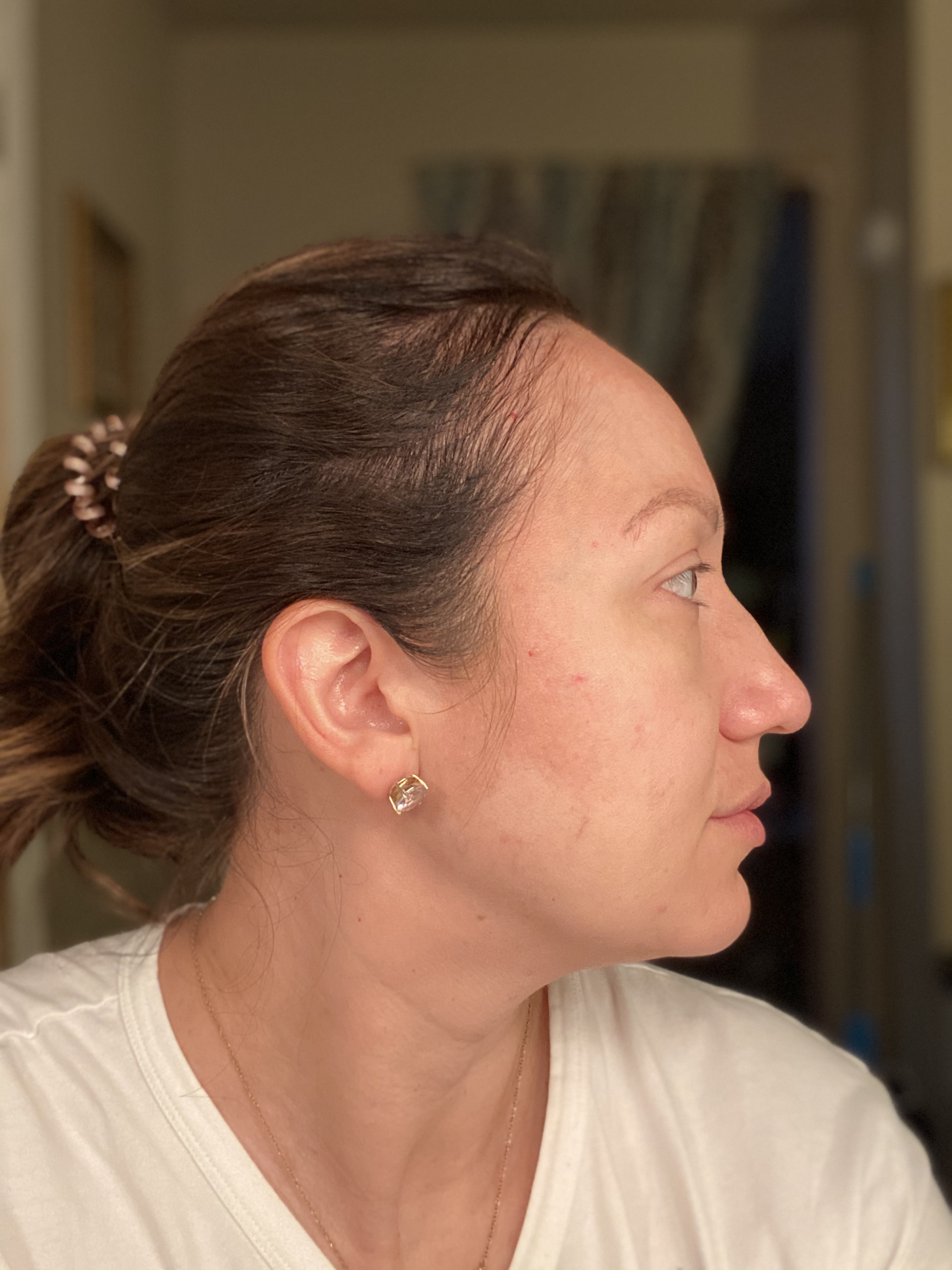 The Spot Cream review photo by raquel M.