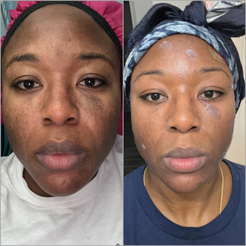 The Anti-Aging Cream review photo by anne E.