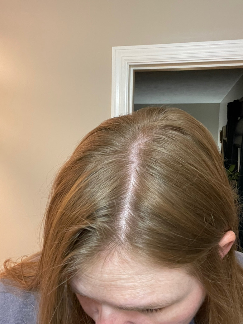 The Hair Topical Solution - Modern review photo by Carolyn  E.