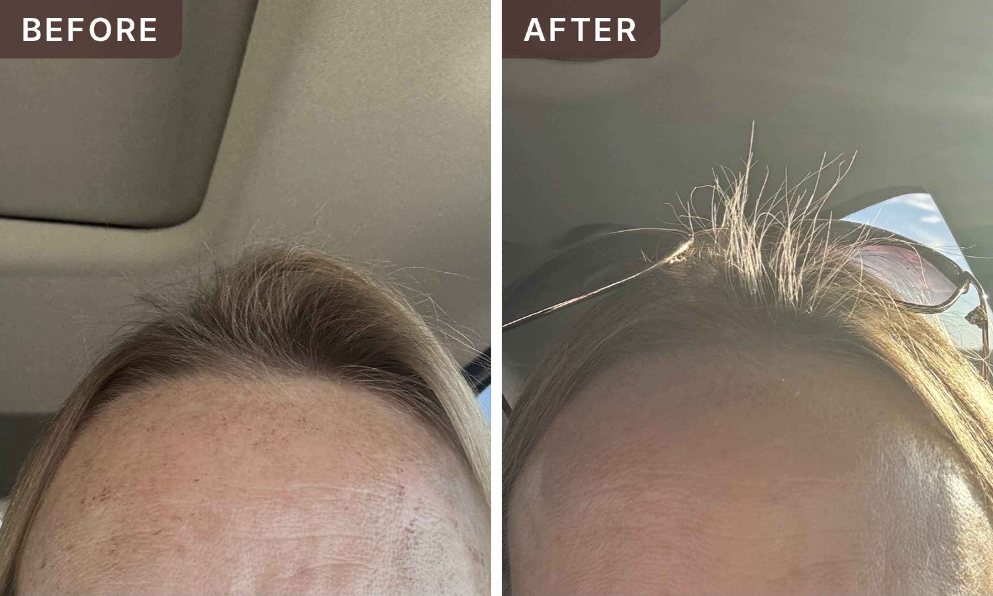 RacyStacy H. -- before and after, 8 weeks