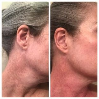 The Anti-Aging Cream review photo by Julie B.