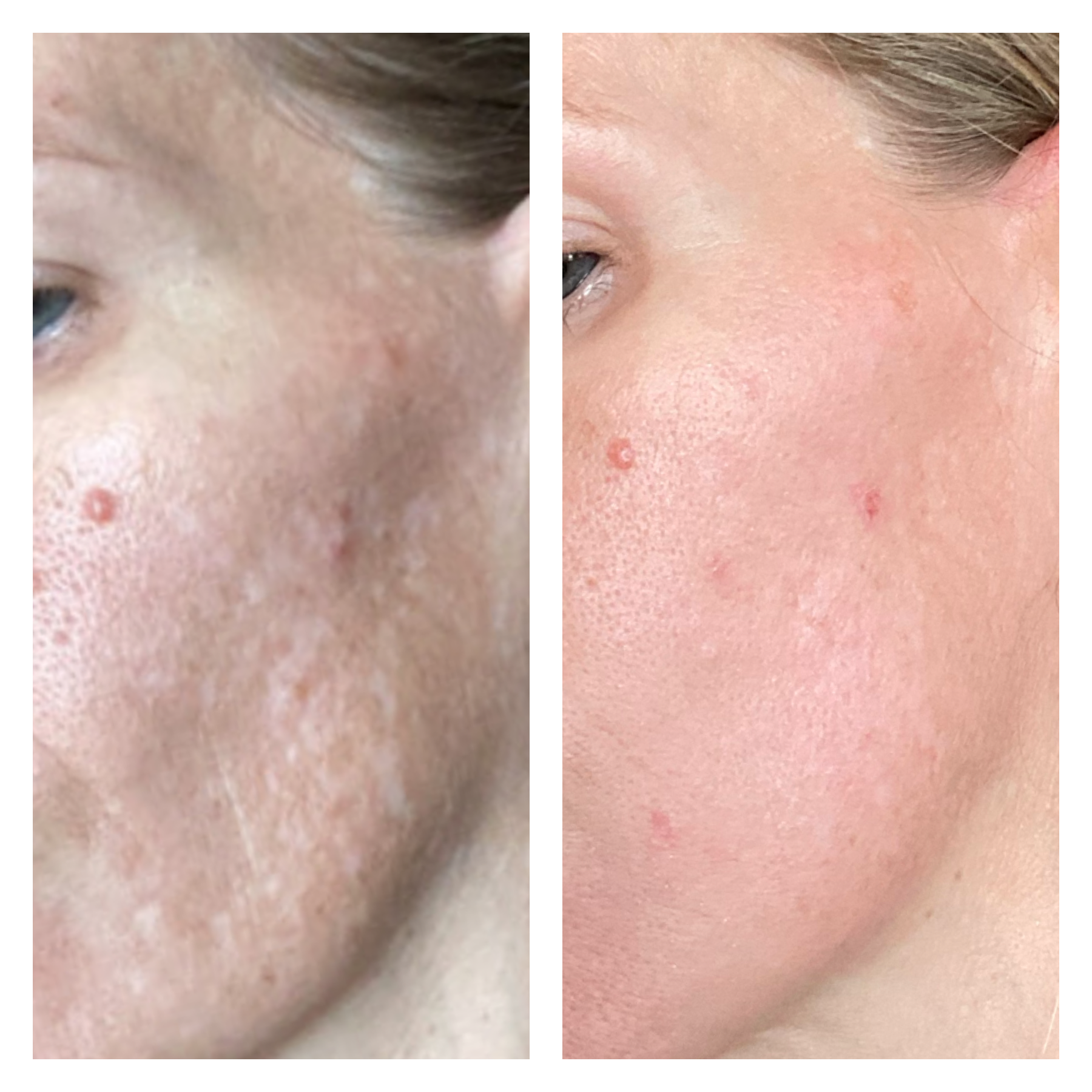 The Spot Cream review photo by Cindy E.