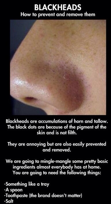 fisting-free-loads-of-blackheads-on-my-breasts-sex-the