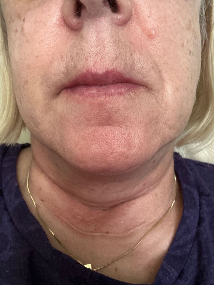 Customer photo
