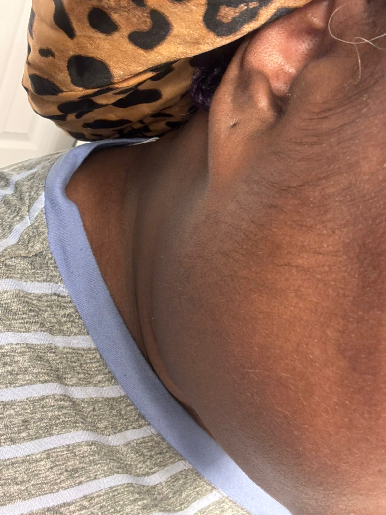 Customer photo