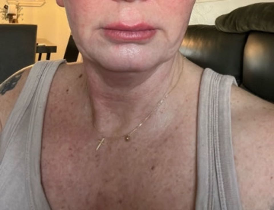 Customer photo