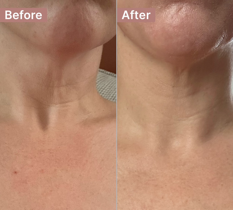Customer photo