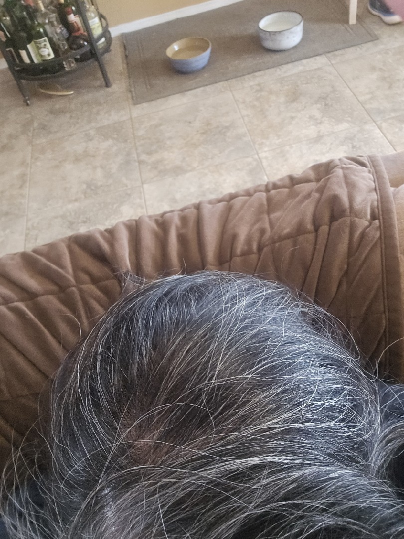 The Hair Topical Solution - Classic review photo by karen C.