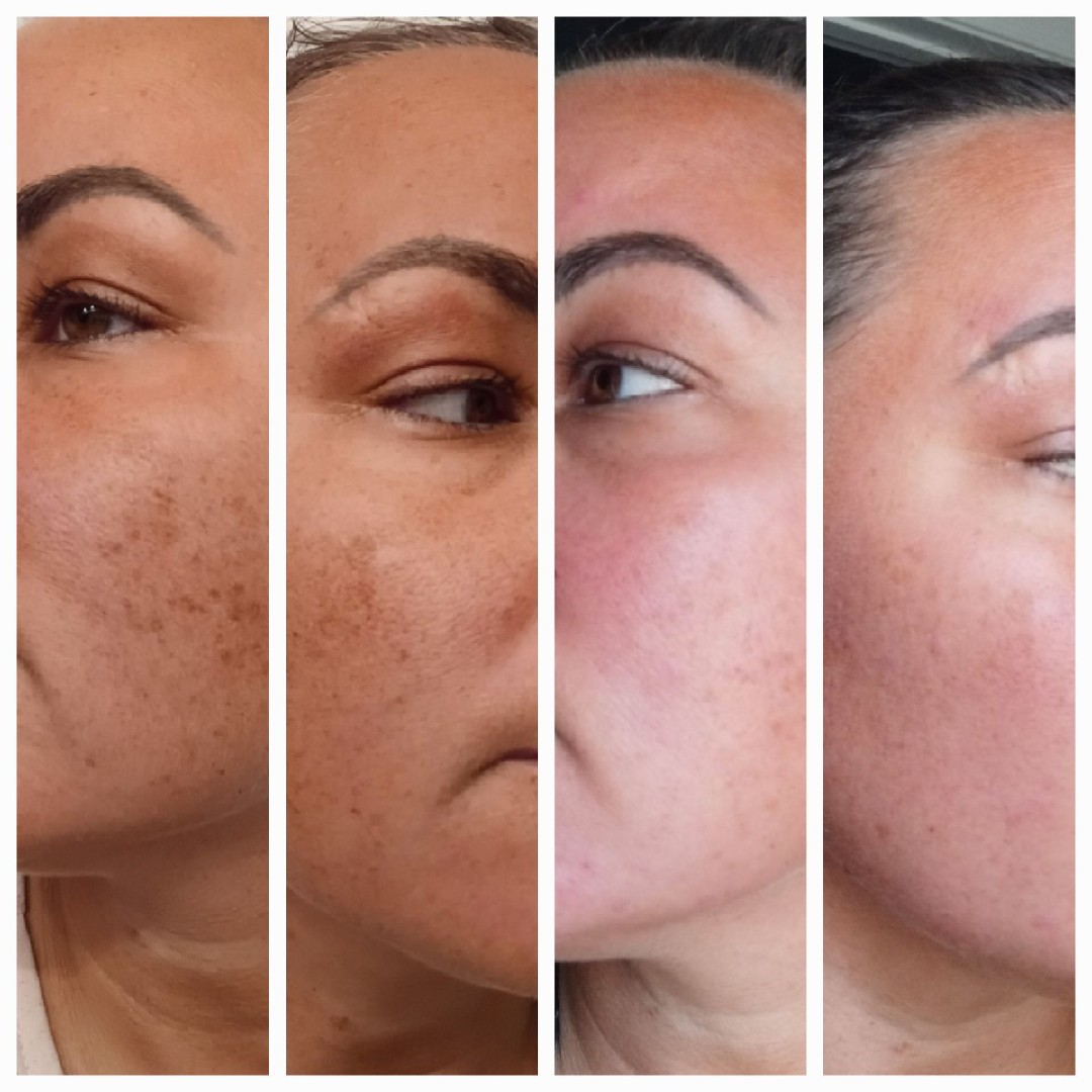 The Spot Cream review photo by Nichole K.