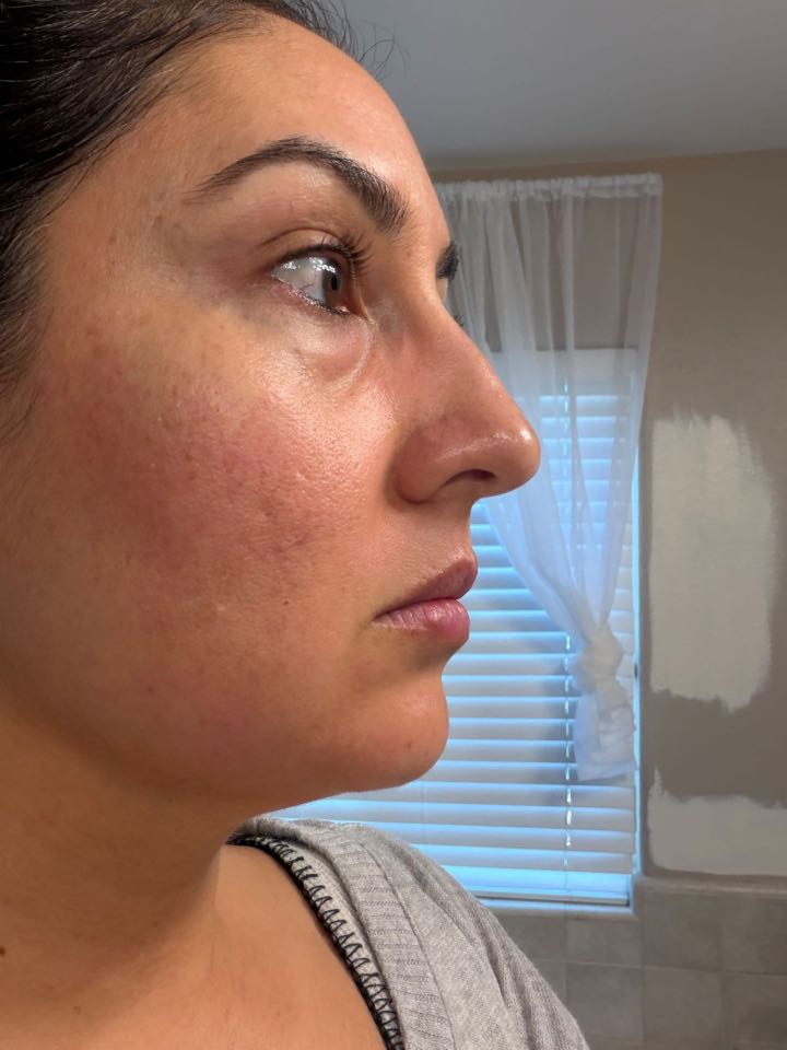 The Eye Serum review photo by Christine H.
