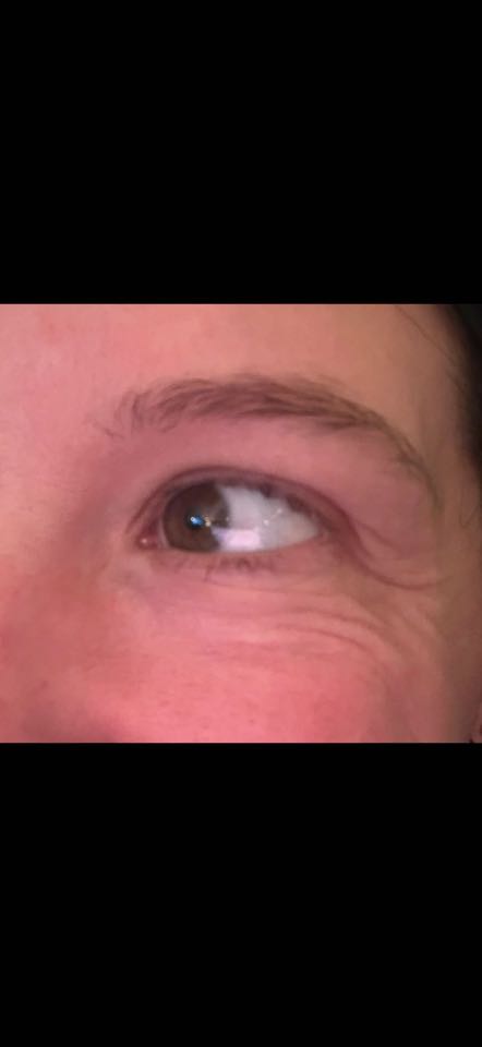 The Eye Serum review photo by Lauren A.
