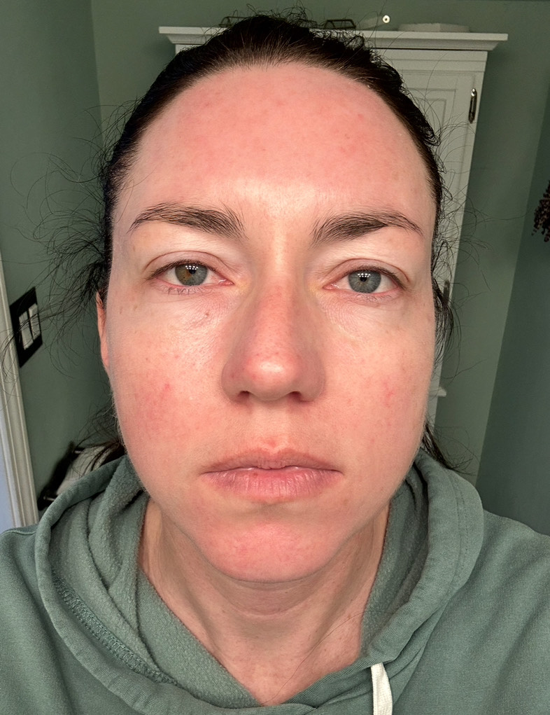 Customer photo