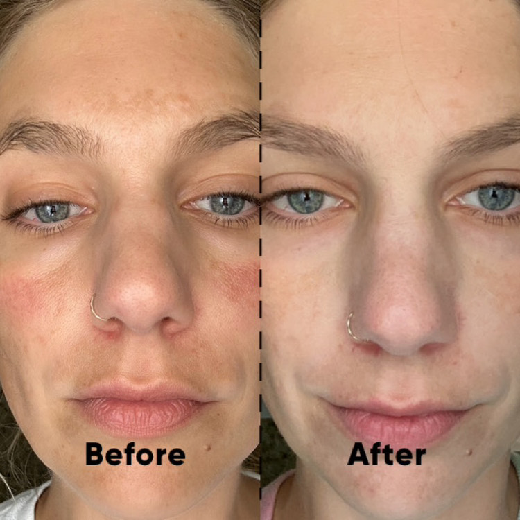 The Spot Cream review photo by Lori L.