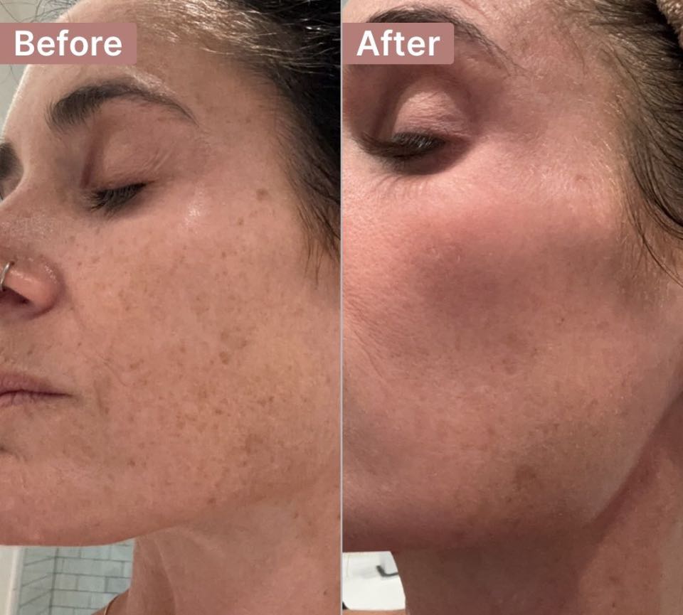 The Spot Cream review photo by Laura S.
