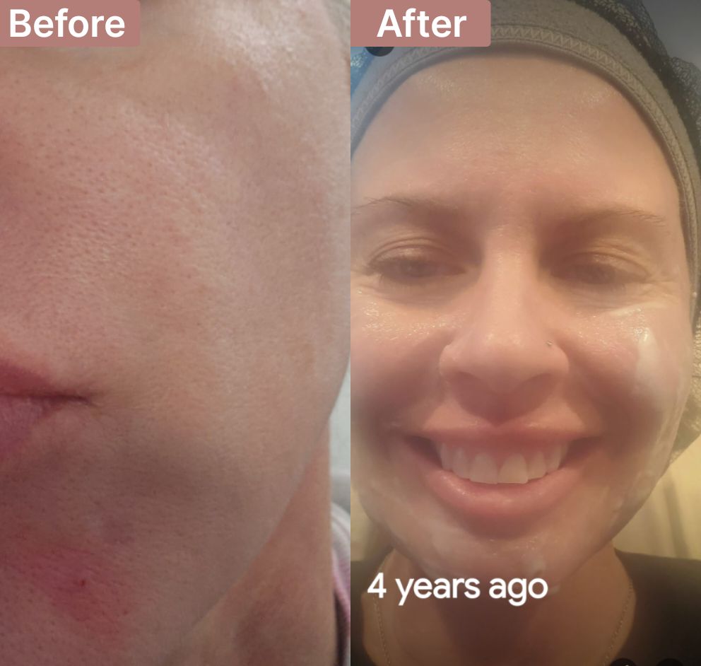 Christina's story