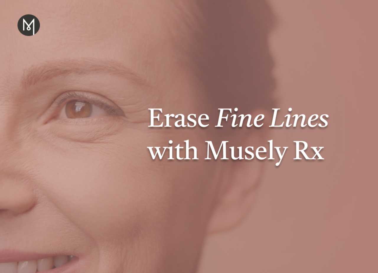 Erase Fine Lines with Musely Rx