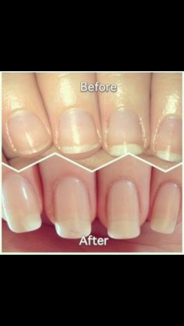 How To Make Nails Longer!! 💅😃 Musely