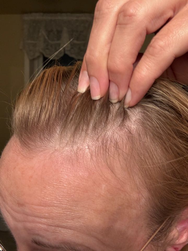 The Hair Topical Solution - Modern review photo by Stacy H.