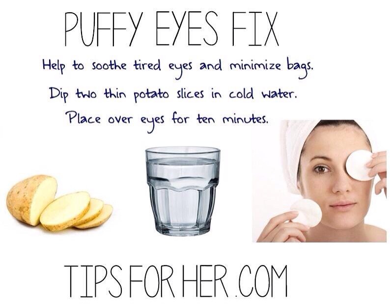 How To Fix Puffy Eyes Musely