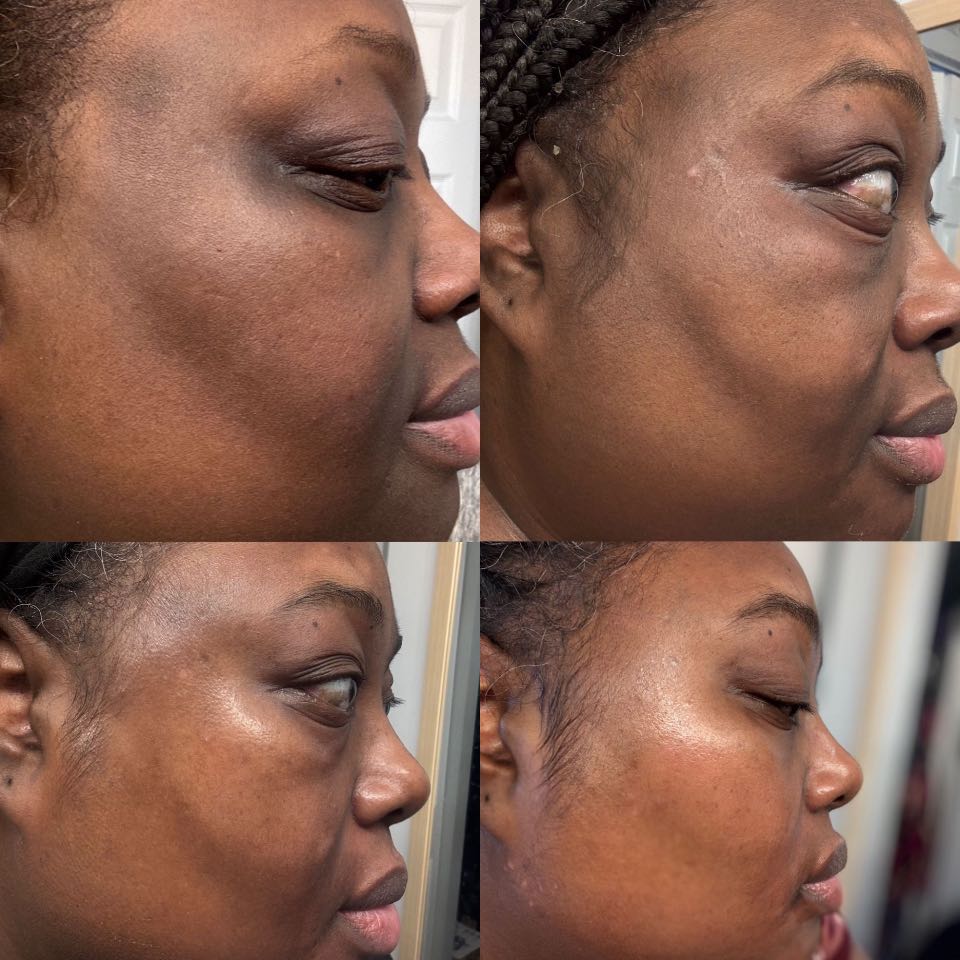 Customer photo
