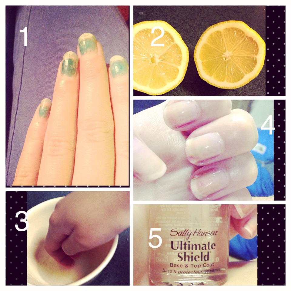 Nail Stains?? Here Is How To Get Rid Of Those Nasty Marks! Musely