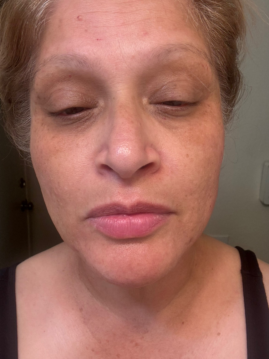 The Spot Cream review photo by Rose S.