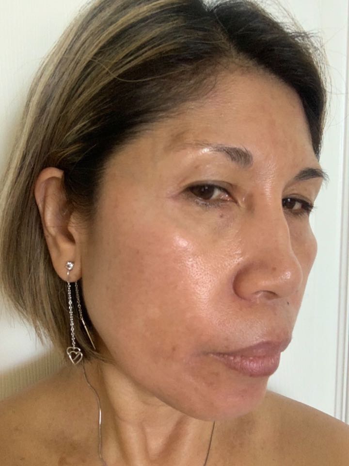 The Spot Cream review photo by Dolores A.