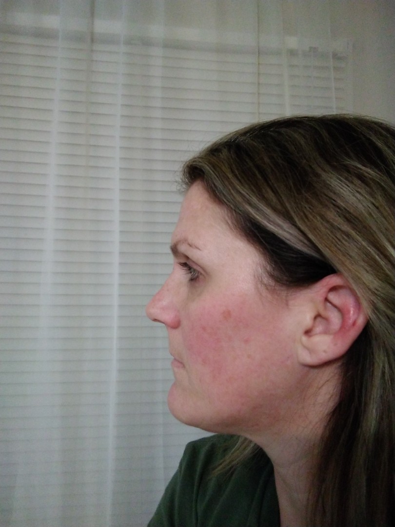 The Spot Cream review photo by Trish L.