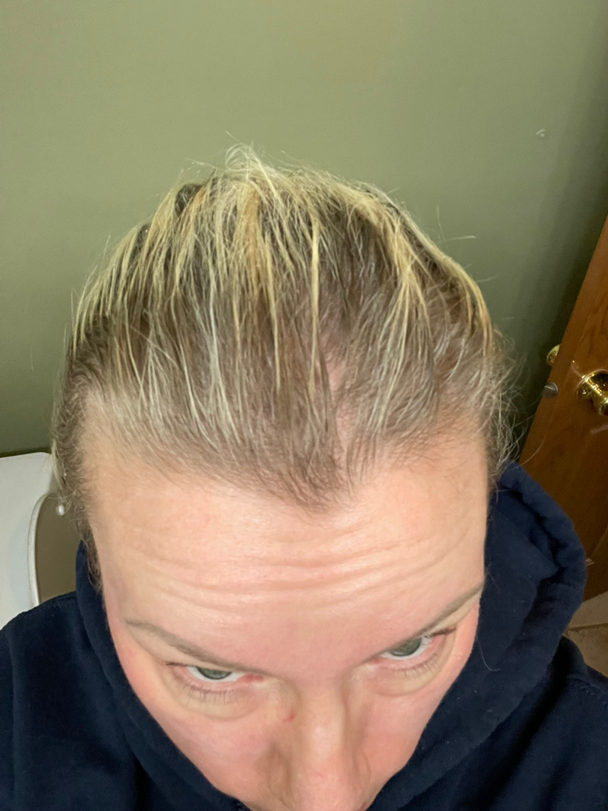 The Hair Pill review photo by Amber H.