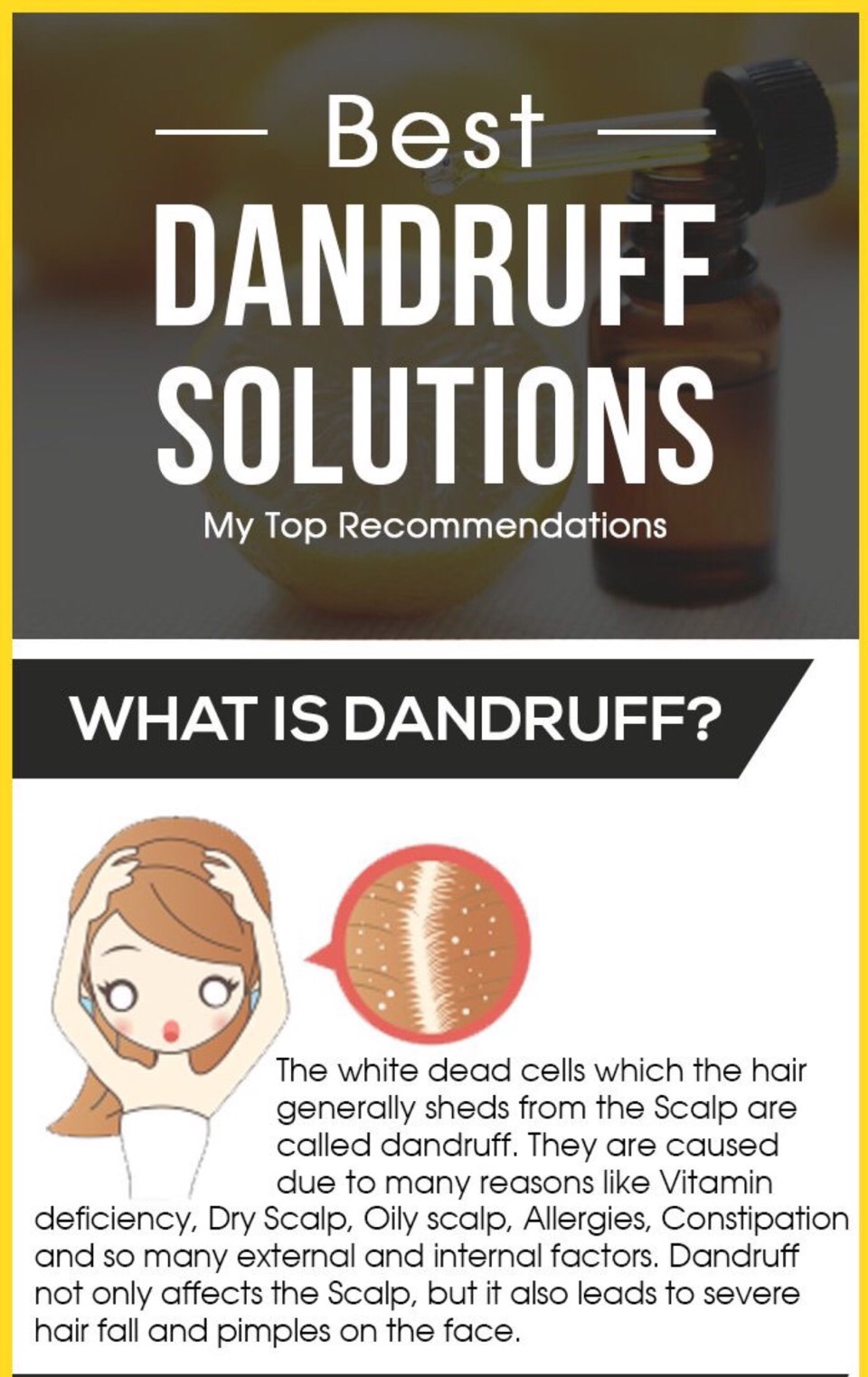 Best Dandruff Solution Musely