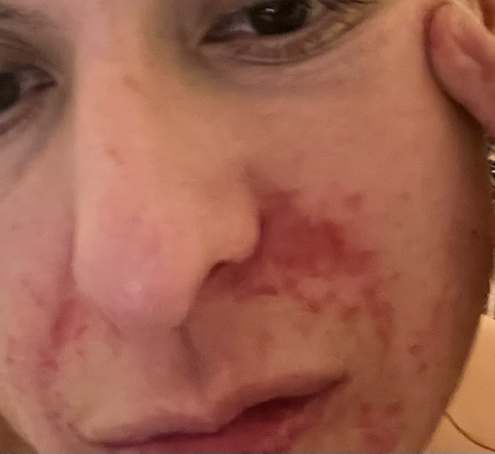 Post attachment 1